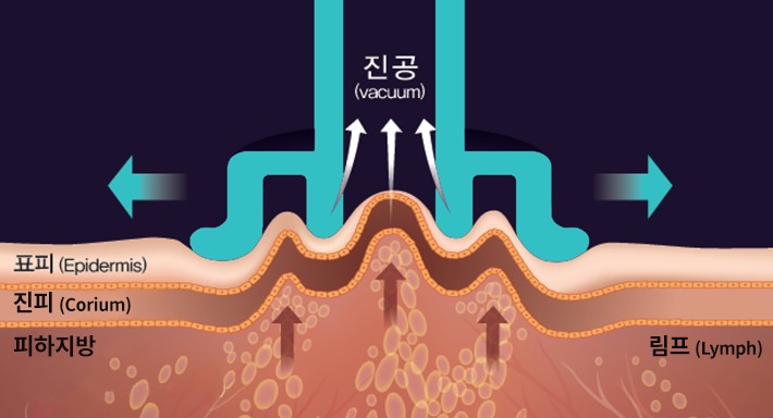 배경 이미지